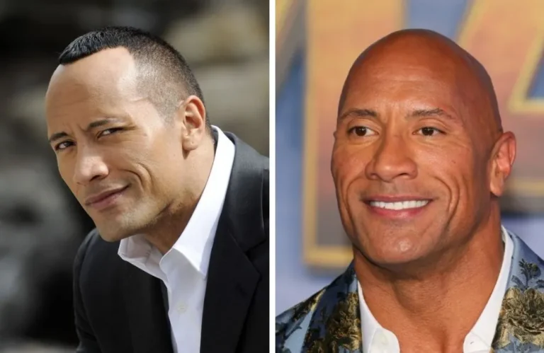 40+ Bald Celebrities: Incredible Transformations from Full Hair to Baldness Revealed!